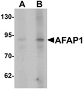AFAP1 Antibody