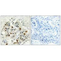 AFF1 Antibody