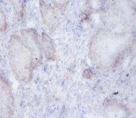 AFG3L2 Antibody