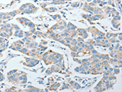 AGA Antibody