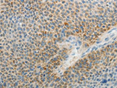 AGAP1 antibody