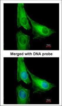 AGAP1 antibody [C3], C-term