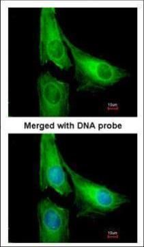 AGAP1 antibody