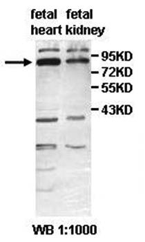 AGAP1 Rabbit Polyclonal Antibody