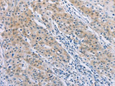 AGAP2 Antibody