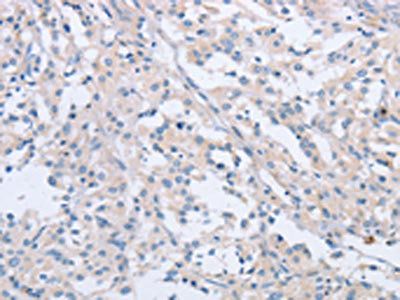 AGAP2 Antibody