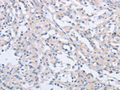 AGAP2 antibody