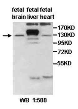 AGAP2 Rabbit Polyclonal Antibody