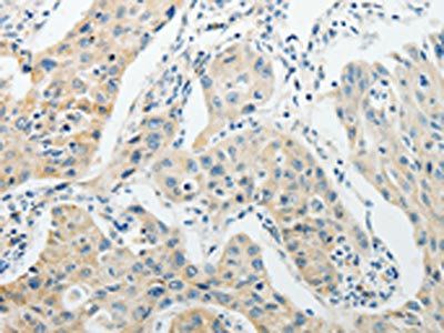 AGBL1 Antibody