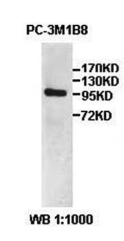 AGBL1 antibody