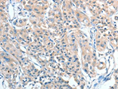 AGBL2 antibody