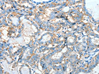 AGBL3 Antibody