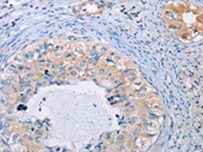 AGBL5 Antibody
