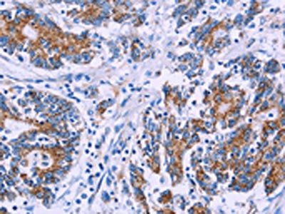 AGFG1 Antibody