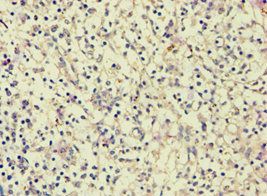 AGGF1 Antibody