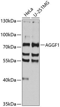 AGGF1 antibody
