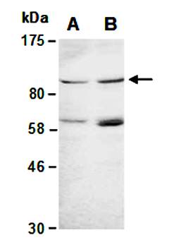 AGO2 (N2) Antibody, Rabbit Polyclonal