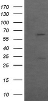 AGPAT5 Antibody