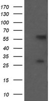 AGPAT5 Antibody
