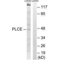 AGPAT5 Antibody