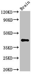 AGPAT5 Antibody