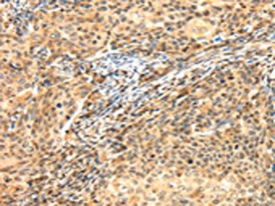 AGPAT9 Antibody