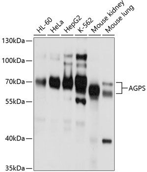 AGPS antibody