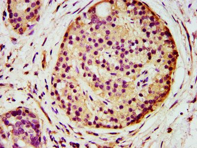 AGPS Antibody