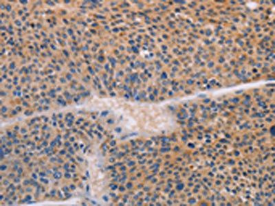 AGPS Antibody