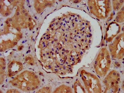 AGRN Antibody