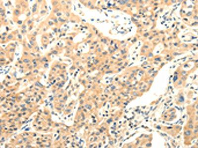 AGRN Antibody