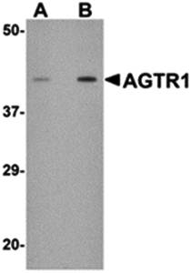 AGTR1 Antibody