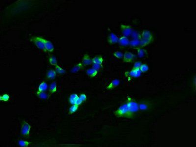 AGTRAP antibody