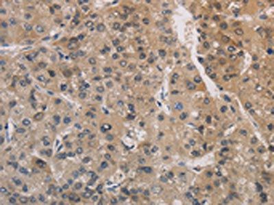 AGTRAP Antibody