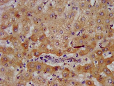 AGXT2 Antibody