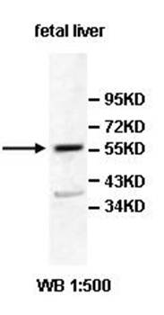 AGXT2 Rabbit Polyclonal Antibody