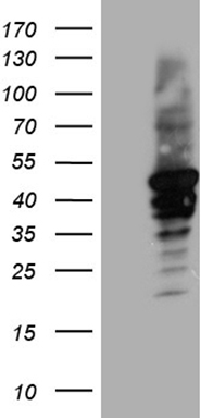 AHA1 (AHSA1) antibody