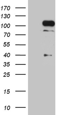 AHA1 (AHSA1) antibody