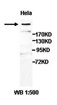 AHCTF1 antibody