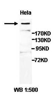 AHCTF1 Rabbit Polyclonal Antibody