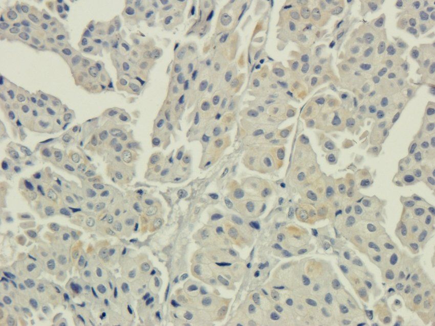 AHI1 antibody