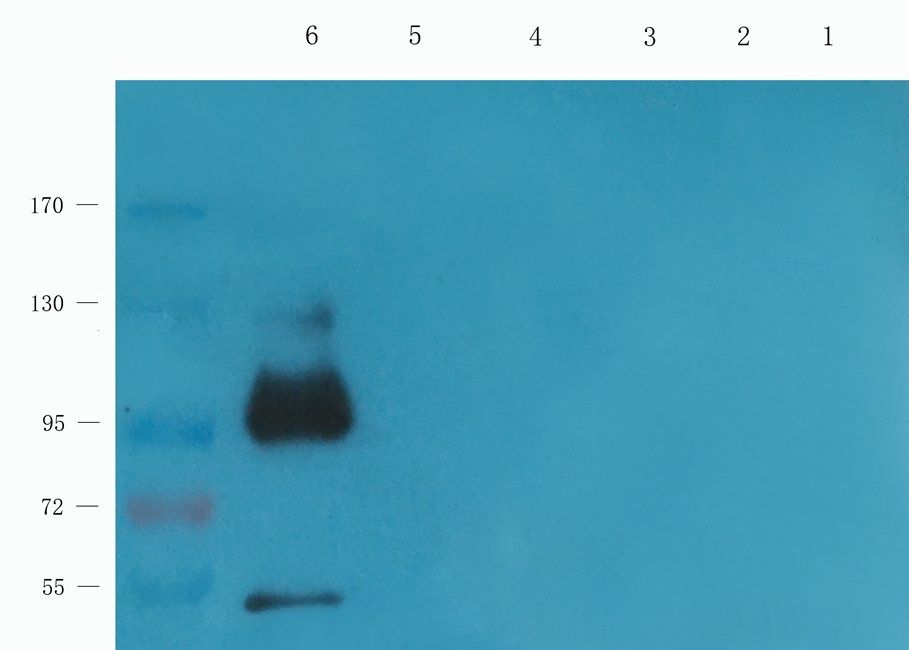 AHI1 Rabbit Polyclonal Antibody