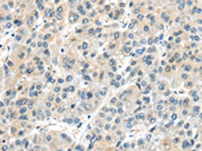 AHI1 Antibody