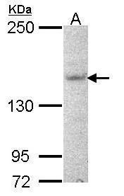 AHI1 antibody [N1], N-term