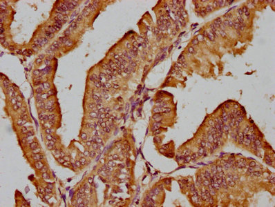 AHI1 antibody