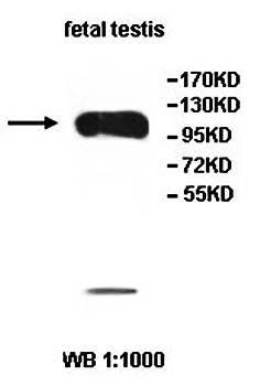 AHI1 Rabbit Polyclonal Antibody