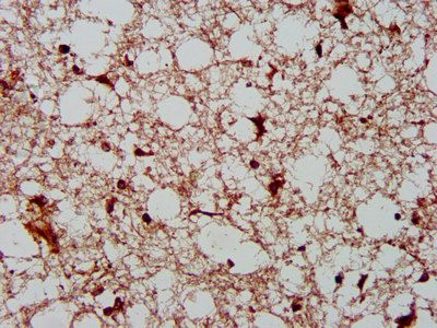 AHNAK2 Antibody