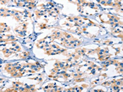AHR Antibody