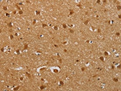 AHSG Antibody