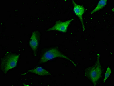 AIDA antibody